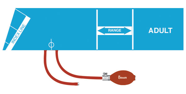 V-Lok Inflation System