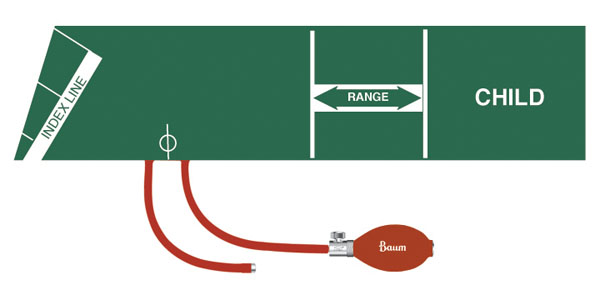 V-Lok Inflation System - Image 2