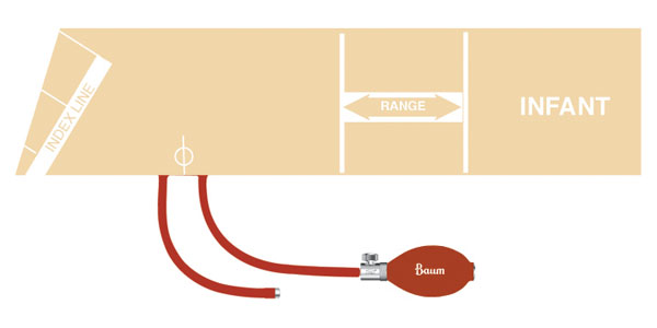 V-Lok Inflation System - Image 3