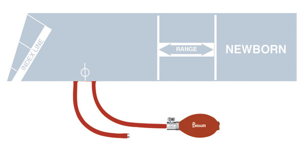 V-Lok Inflation System - Image 4