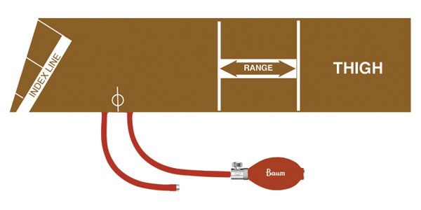 V-Lok Inflation System - Image 5