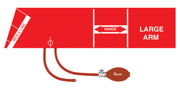 V-Lok Inflation System - Image 6