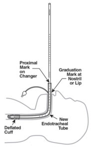 Endotracheal Tube Changer - Bay Medical