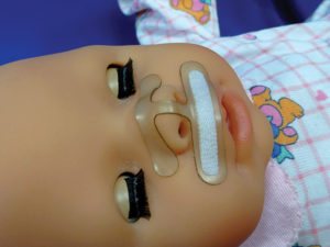 Septal-H™ Neonatal Nasal Cannula Stabilization Device