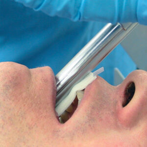 DentaSafe Dental Guard Strip