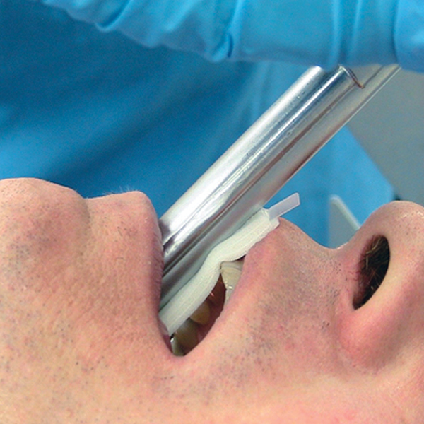 DentaSafe Dental Guard Strip