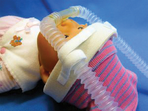 Capette™ Tube Support System